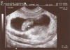 Baby "B" -- resting on its side